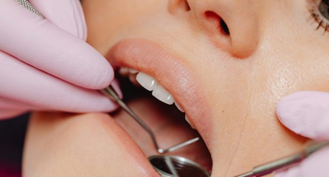 Gum Surgeries