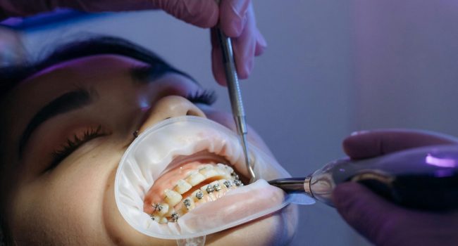 dental